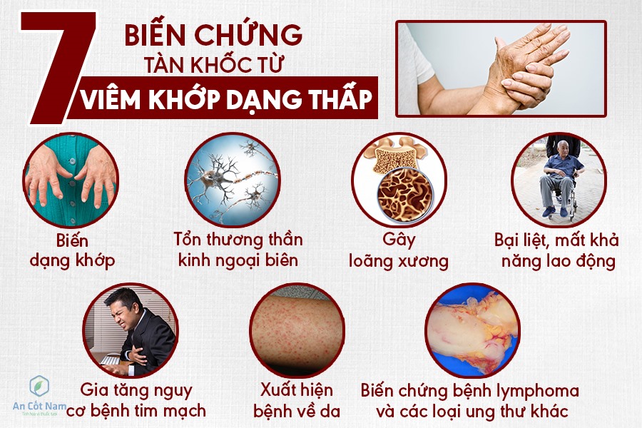 Nguyên Nhân Bệnh Xương Khớp