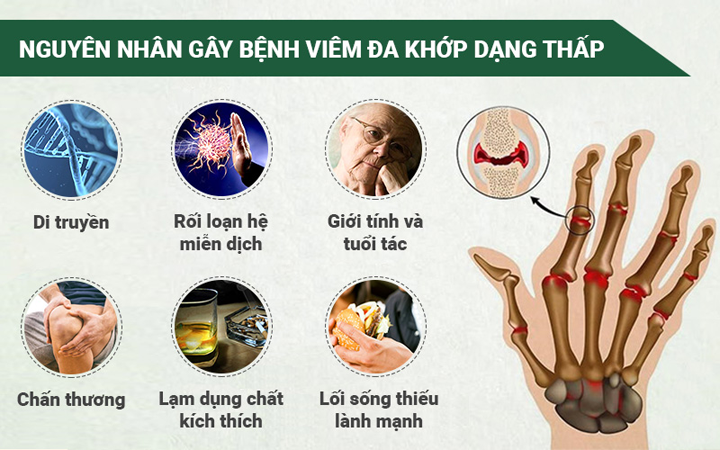 Nguyên nhân gây ra bệnh viêm đa khớp