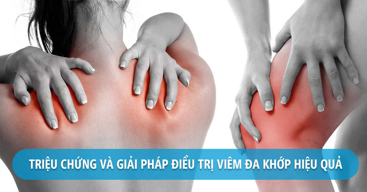 Triệu chứng và điều trị viêm đa khớp hiệu quả