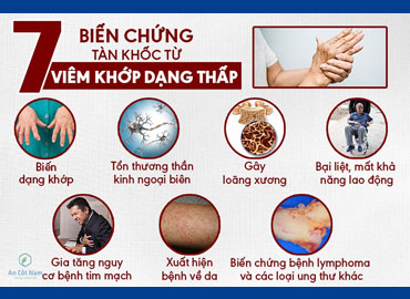 Nguyên Nhân Bệnh Xương Khớp và Lợi Ích của Cao Cá Sấu Hoa Cà